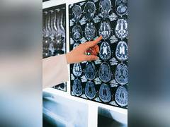 
      
      Brief exposure to air pollution has rapid impacts on brain
      
      