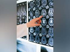 
      
      Study reveals how brains turn into smarter disease fighters
      
      