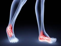
      
      New breakthrough in rheumatoid arthritis treatment
      
      