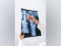 
      
      AI can improve lung nodule detection in chest x-rays: Study
      
      