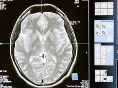 
      
      An insight into brain disorders and human cognition
      
      