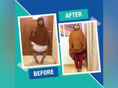
      
      16-year-old girl's life transformed with corrective surgery
      
      