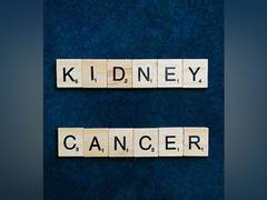 
      
      Biomarker predict how kidney cancer patients respond to therapy
      
      