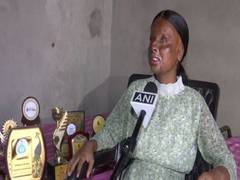 
      
      Acid attack survivor, peon's daughter, tops in school with 95 pc 
      
      