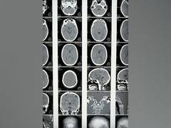 
      
      Brain's primary auditory cortex is more responsive to human vocal
      
      