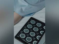 
      
      Monitoring blood vessel changes improves detection of brain...
      
      