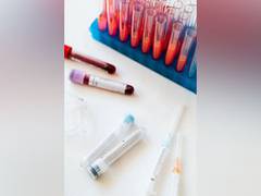
      
      New blood serum test to detect neurodegenerative disorders: Study
      
      