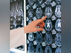 
      
      How brain adapts to various situations, study explores 
      
      