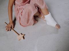 
      
      Premature, low birthweight newborns suffer fewer fractures 
      
      