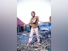 
      
      Children who stay near busy roads may develop atopic dermatitis
      
      