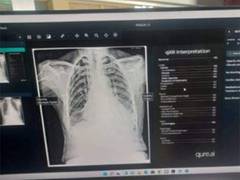 
      
      J-K: Shopian hospital introduces AI in radiology department
      
      