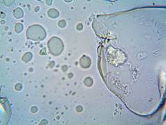 
      
      Drug delivery method reverse senescence of stem cells: Study
      
      