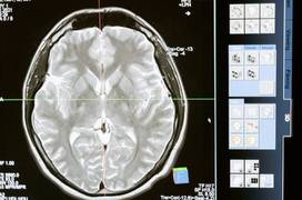 
      
      Study establishes direct connection between brain waves, memory
      
      