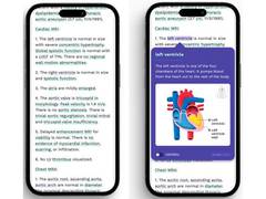 
      
      Aarthi Scans introduces Smart Reports for MRI and CT Scans
      
      