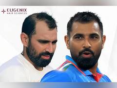 
      
      Mohammed Shami: A Stunning Transformation On and Off the Pitch
      
      