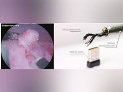
      
      Agilis Robotics Unveils Advancements in Endoluminal Surgery
      
      