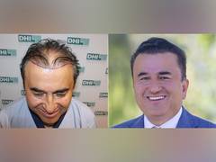 
      
      Why is India a Growing Hair Transplant Destination?
      
      