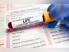 
      
      When Should You Get Liver Function Tests Done?
      
      