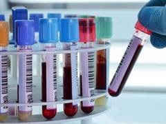 
      
      Aarogya Pathcare Expands Its Health Testing at Home Service
      
      