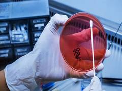 
      
      Asia-Pacific countries alarmed to tackle antimicrobial resistance
      
      