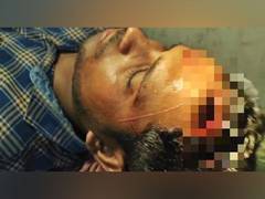 
      
      ANI stringer Bunty Mukherjee gets severely injured in TMC-BJP clash
      
      