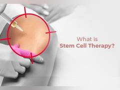 
      
      What Is Stem Cell Therapy? How Does It Work?
      
      