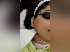 
      
      Sculpt Clinics Revolutionizes Laser Hair Removal 
      
      