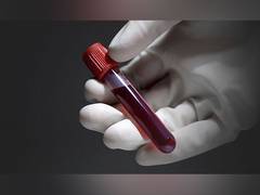 
      
      Which Blood Test Can Help Detect Infections?
      
      