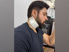 
      
      Emraan Hashmi gets injured during 'Goodachari 2' in Hyderabad
      
      