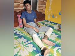 
      
      WB: 16-year-old suffered minor injury from suspected bomb
      
      