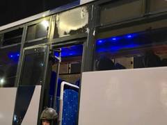 
      
      Terror attack of Jerusalem leaves young boy in serious condition
      
      