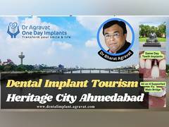
      
      Dr Agravat Dental Implants Tourism in India's First Heritage City
      
      