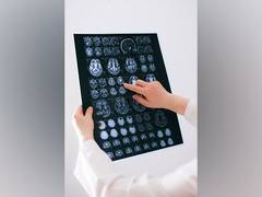 
      
      Brain map clarifies neuronal connectivity behind motor function
      
      