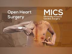 
      
      A Traveler’s Guide to Minimally Invasive Cardiac Surgery
      
      