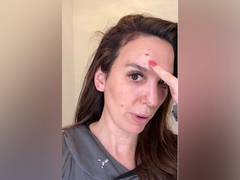 
      
      Christy Carlson Romano shares she was “shot in the eye”
      
      