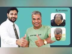 
      
      Actor Producer Bharat Jadhav Overcomes Failed Hair Treatment
      
      