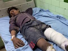 
      
      UP: One dead, four injured after wall of brick kiln collapses
      
      