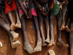 
      
      Over 3k Palestinian children admitted for acute malnutrition, UN 
      
      