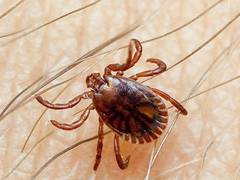 
      
      Pakistan reports three deaths from Congo virus 
      
      