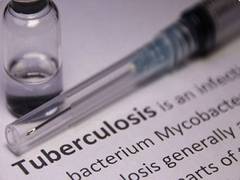 
      
       ICMR-NIE unveils TB tool
      
      