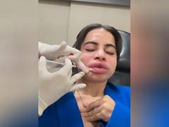 
      
      Uorfi Javed shares video of her getting lip fillers dissolved
      
      
