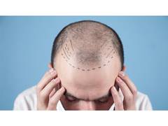 
      
      Dermatologist vs. Hair Transplant Surgeon: Who’s Best
      
      