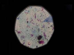 
      
      Philippines accelerates TB elimination drive 
      
      