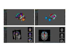 
      
      AnaVu: IIIT-Hyderabad’s 3D Anatomy Visualization Platform 
      
      