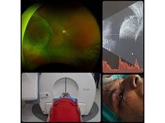 
      
      Army Hospital R&R performs Gamma Knife Therapy in 38-year-old ser
      
      