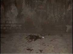 
      
      Delhi acid attack survivor demands justice
      
      