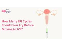 
      
      How Many IUI Cycles Should You Try Before Moving to IVF?
      
      