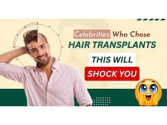 
      
      Celebrity Hair Transplant: You'd Never Guess They Had a Hair...
      
      