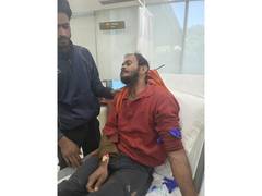 
      
      Steel rod through skull: how Gurugram doctors saved a man
      
      