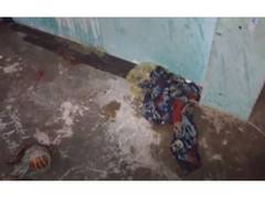 
      
      Delhi: Bride-to-be critical after acid attack, accused woman arre
      
      